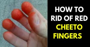 How to Get Rid of Red Cheeto Fingers (7 Effective Ways)