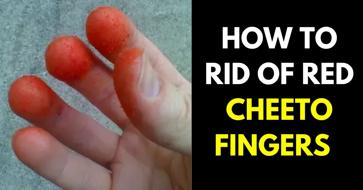 How to Get Rid of Red Cheeto Fingers